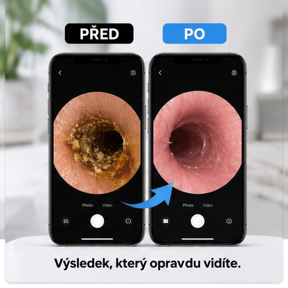 Chytrý čistič uší s integrovanou HD kamerou